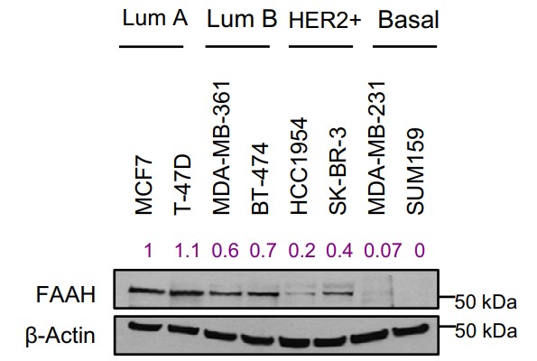 Representative WB analysis of FAAH in a panel of human BC cell lines representative of the main intrinsic subtypes.jpg